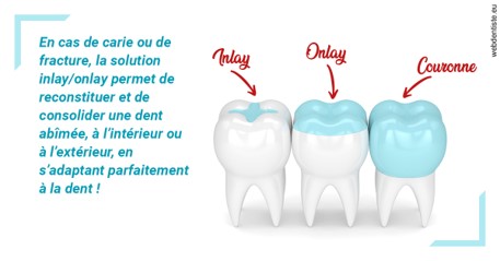 https://dr-speisser-jean-michel.chirurgiens-dentistes.fr/L'INLAY ou l'ONLAY