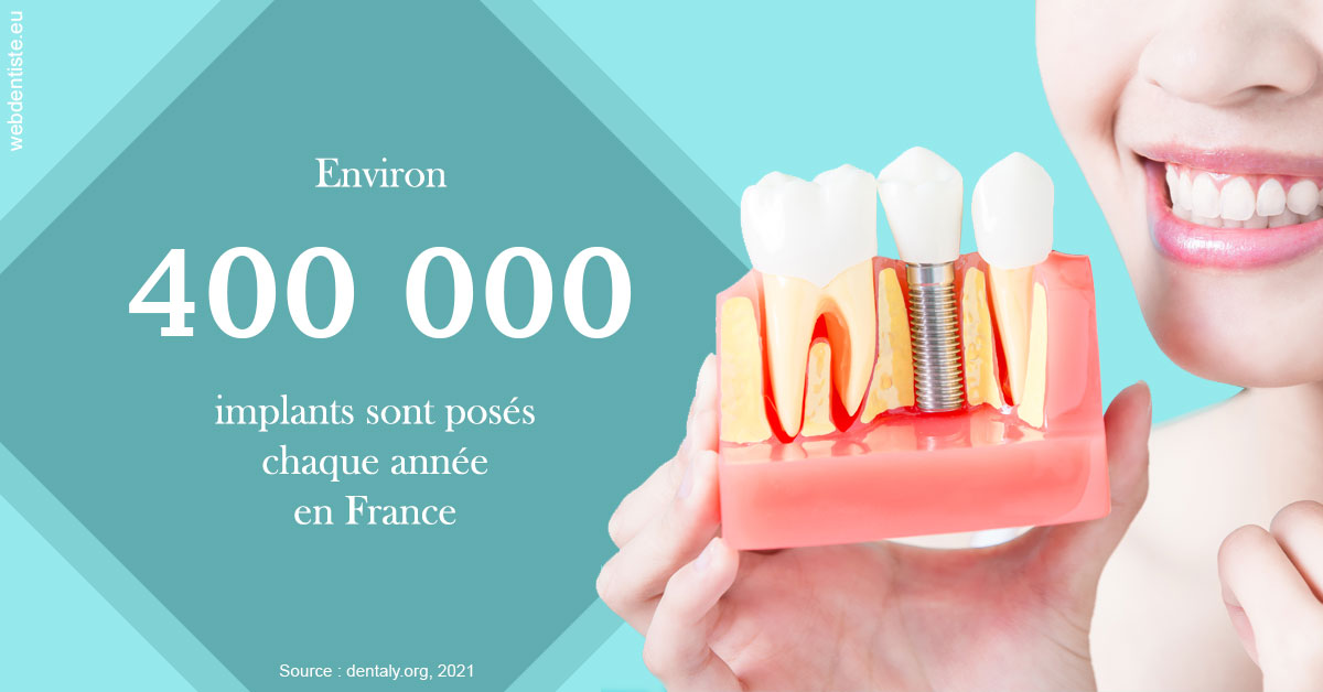 https://dr-speisser-jean-michel.chirurgiens-dentistes.fr/Pose d'implants en France 2